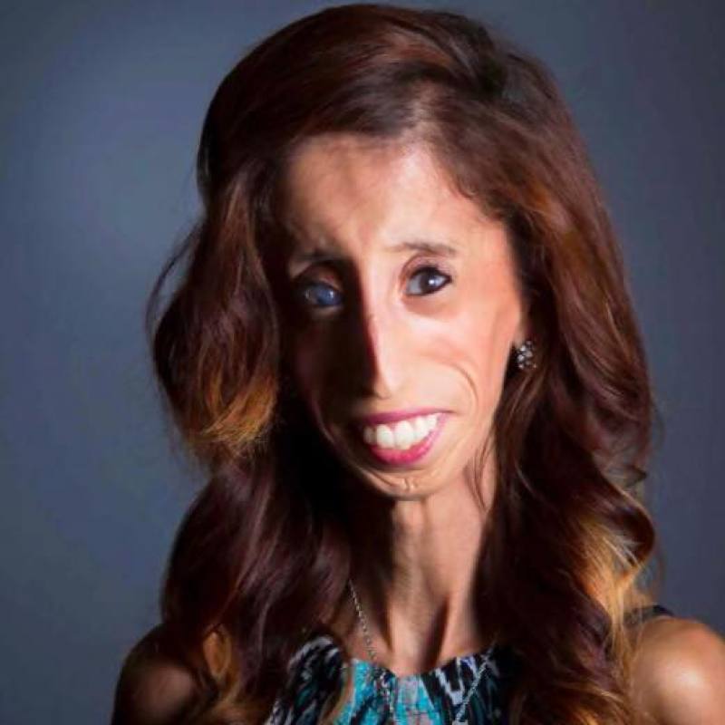 Lizzie Velasquez