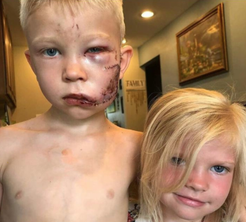Brave young boy saves little sister from dog attack. 