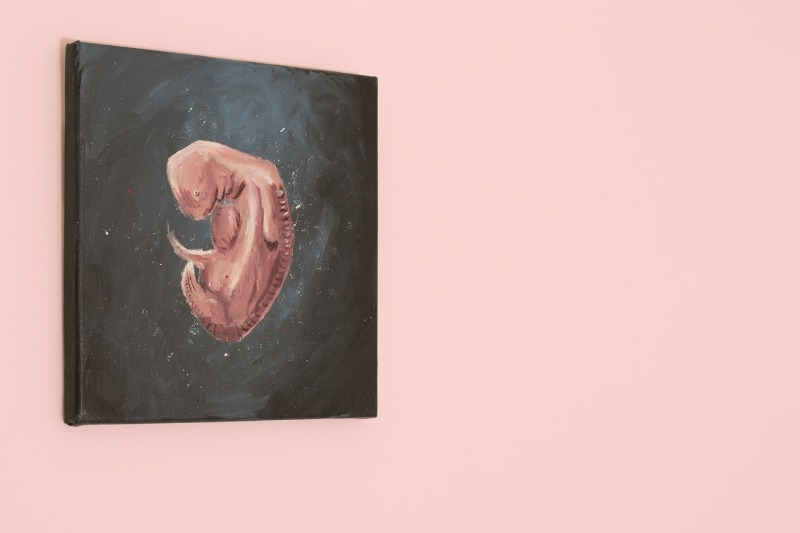 Fetus Painting 